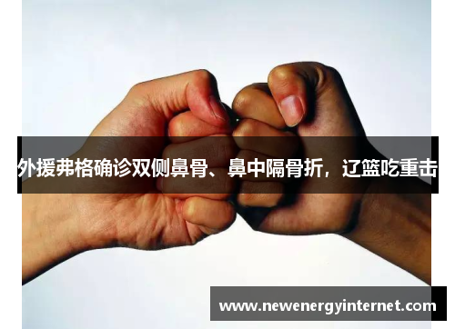 外援弗格确诊双侧鼻骨、鼻中隔骨折，辽篮吃重击